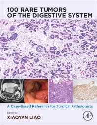 100 Rare Tumors of the Digestive System