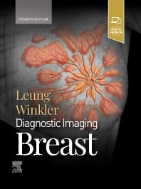 Diagnostic Imaging: Breast