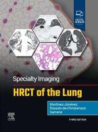 Specialty Imaging: HRCT of the Lung