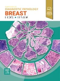 Diagnostic Pathology: Breast