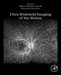 Ultra Widefield Imaging of the Retina