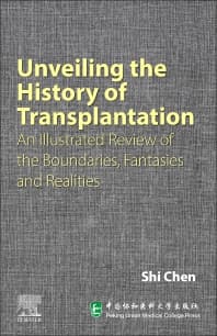 Unveiling the History of Transplantation