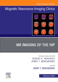 MR Imaging of the Hip, An Issue of Magnetic Resonance Imaging Clinics of North America