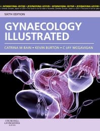 Gynaecology Illustrated International Edition