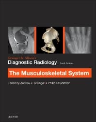 Grainger & Allison’s Diagnostic Radiology: Musculoskeletal System