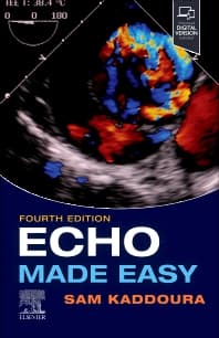 Echo Made Easy