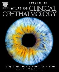 Atlas of Clinical Ophthalmology With CD-ROM