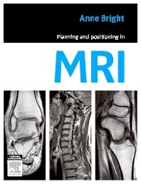 Planning and Positioning in MRI