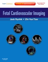 Fetal Cardiovascular Imaging: A Disease Based Approach