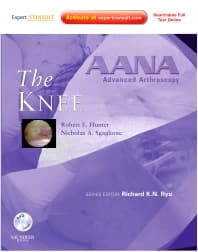 AANA Advanced Arthroscopy: The Knee