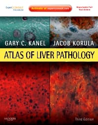 Atlas of Liver Pathology