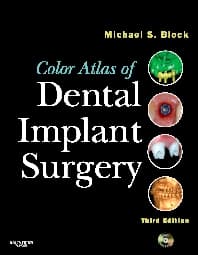 Color Atlas of Dental Implant Surgery