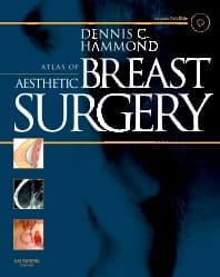 Atlas of Aesthetic Breast Surgery