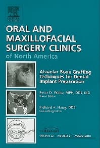 Alveolar Bone Grafting Techniques for Dental Implant Preparation, An Issue of Oral and Maxillofacial Surgery Clinics