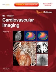 Cardiovascular Imaging, 2-Volume Set