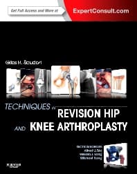 Techniques in Revision Hip and Knee Arthroplasty