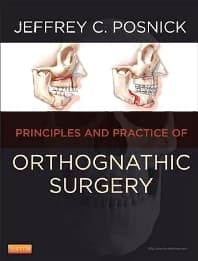 Orthognathic Surgery - 2 Volume Set