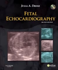 Fetal Echocardiography