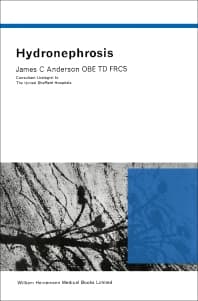 Hydronephrosis