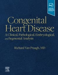 Congenital Heart Disease