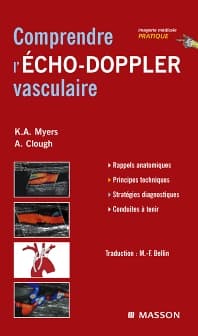 Comprendre l'Echo-Doppler vasculaire