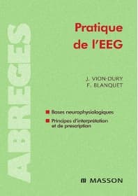 Pratique de l'EEG