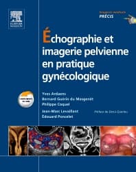 Échographie et imagerie pelvienne en pratique gynécologique