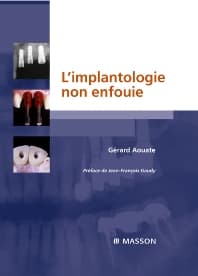 L'implantologie non enfouie