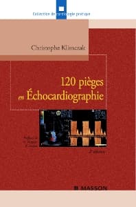 120 pièges en Échocardiographie