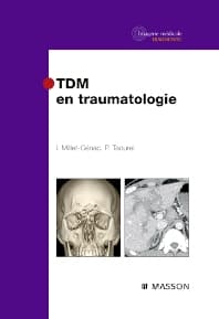 TDM en traumatologie