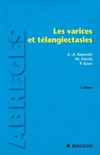 Les varices et télangiectasies