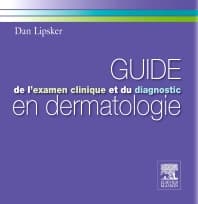 Guide de l'examen clinique et du diagnostic en dermatologie