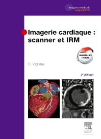 Imagerie cardiaque : scanner et IRM