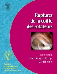 Ruptures de la coiffe des rotateurs