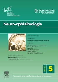 Neuro-ophtalmologie