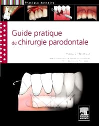 Guide pratique de chirurgie parodontale