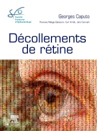 Décollements de rétine