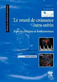 Le retard de croissance intra-utérin