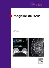 Imagerie du sein