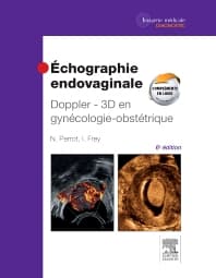 Échographie endovaginale Doppler - 3D