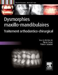 Dysmorphies maxillo-mandibulaires