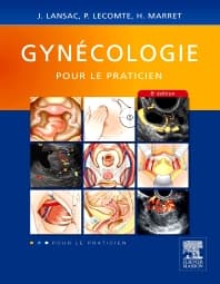 Gynécologie