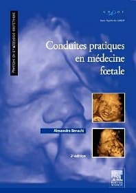 Conduites pratiques en médecine foetale