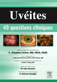 Uvéites : 49 questions cliniques