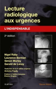 Lecture radiologique aux urgences : l'indispensable