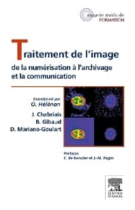 Traitement de l'image