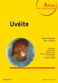 Uvéite