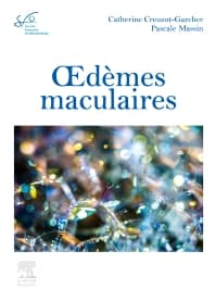 Oedèmes maculaires