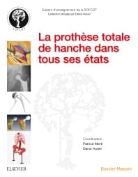 La prothèse totale de hanche dans tous ses états