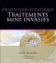 Dentisterie esthétique : traitements mini-invasifs